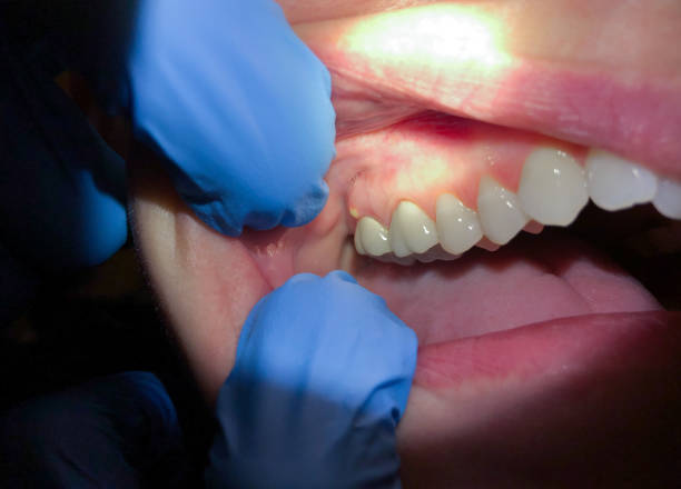 Best Emergency Denture Repair in Waterman, IL